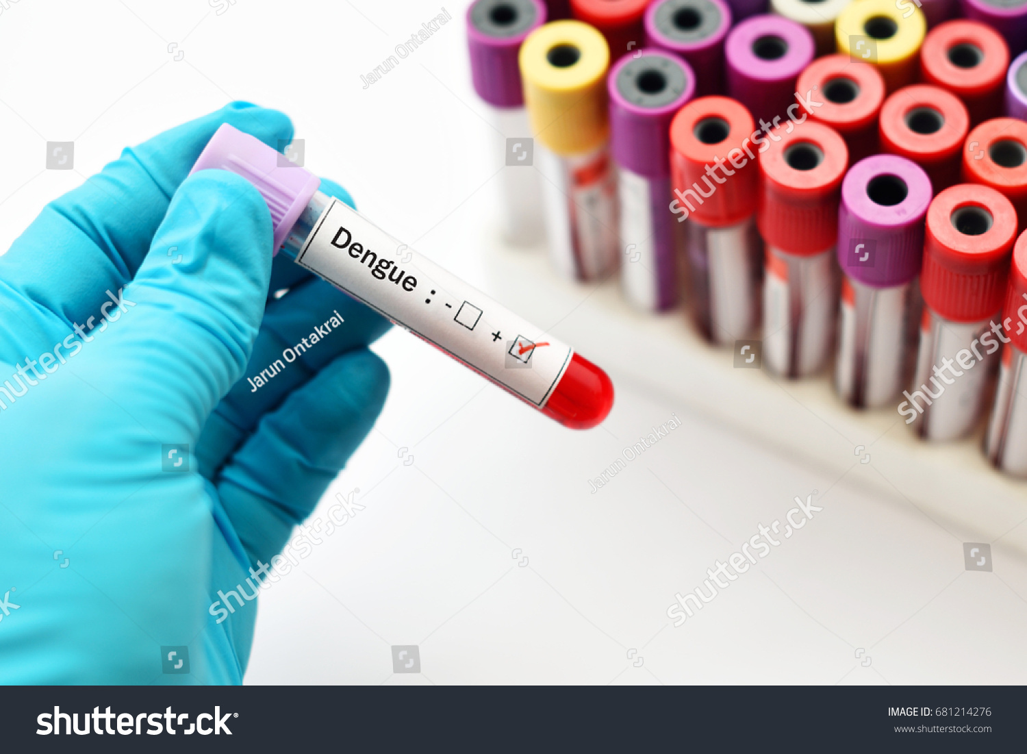 303 Dengue positive Images, Stock Photos & Vectors | Shutterstock