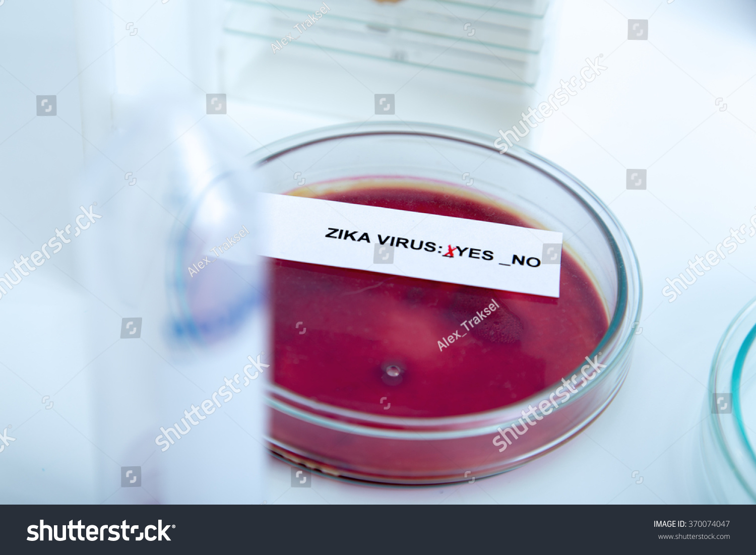 Blood Sample Positive Zika Virustoned Image Stock Photo 370074047