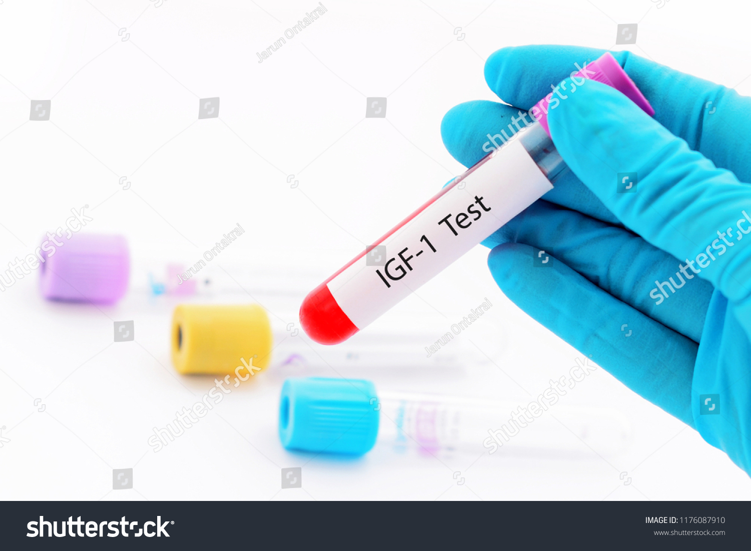 Blood Sample Tube Somatomedin C Insulinlike Stock Photo 1176087910 ...