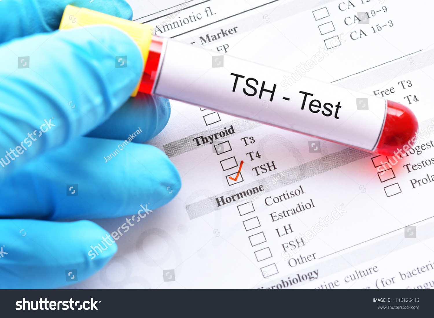 thyroid-stimulating-hormone-images-stock-photos-vectors-shutterstock