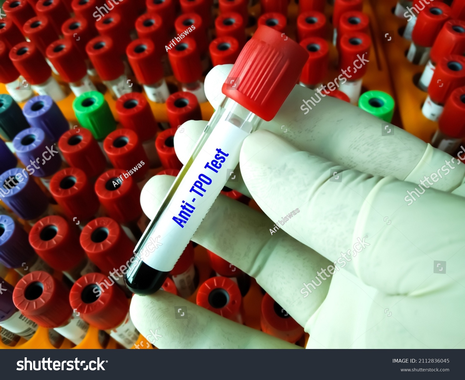 Blood Sample Requisition Form Antitpo Atpo Stock Photo (Edit Now ...