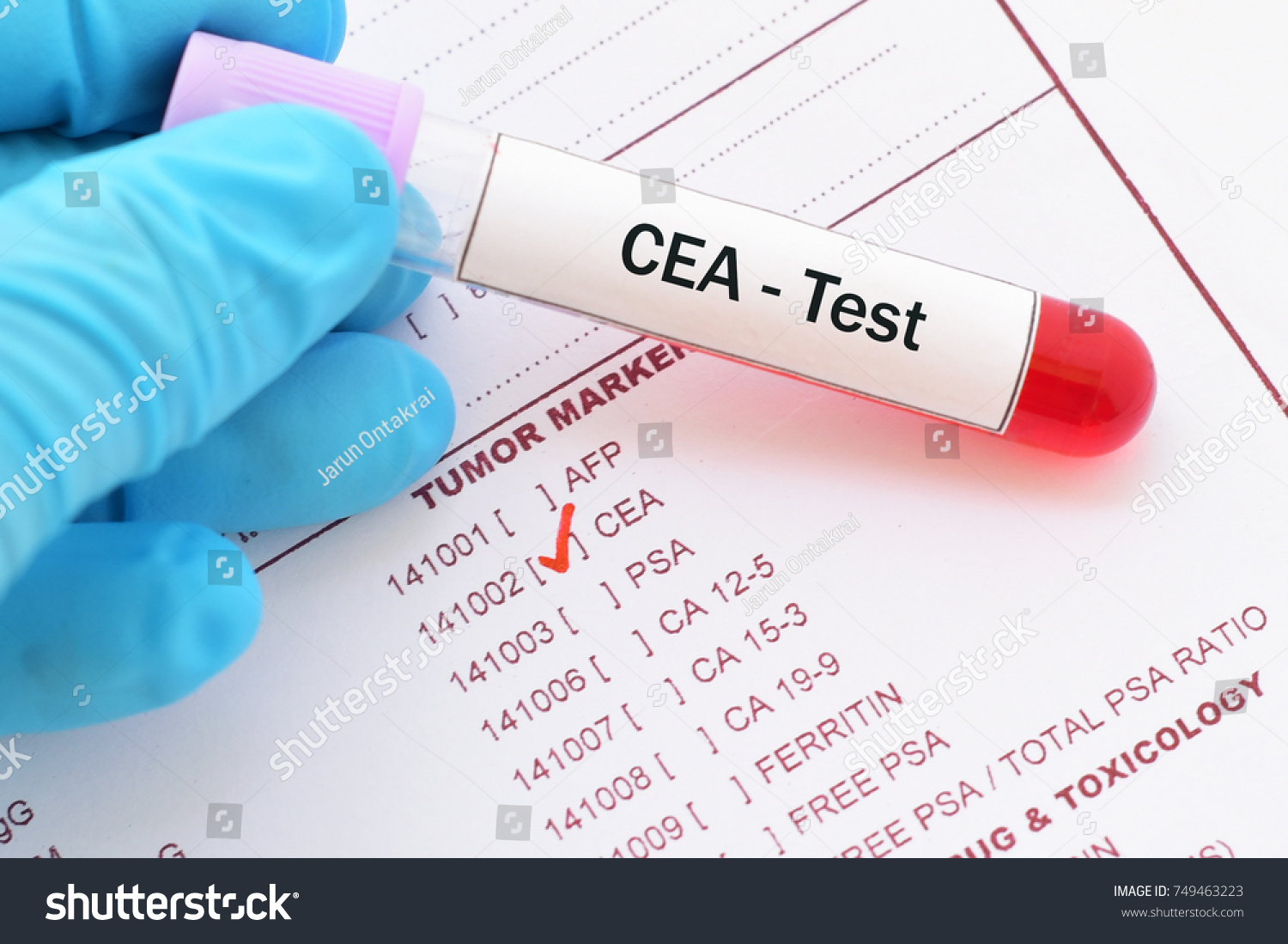 Blood Sample Requisition Form Cea Test Royalty Free Stock Image