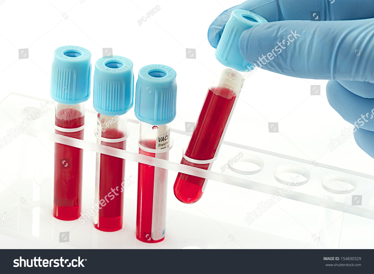 Blood Samples Rack Stock Photo 154830329 - Shutterstock