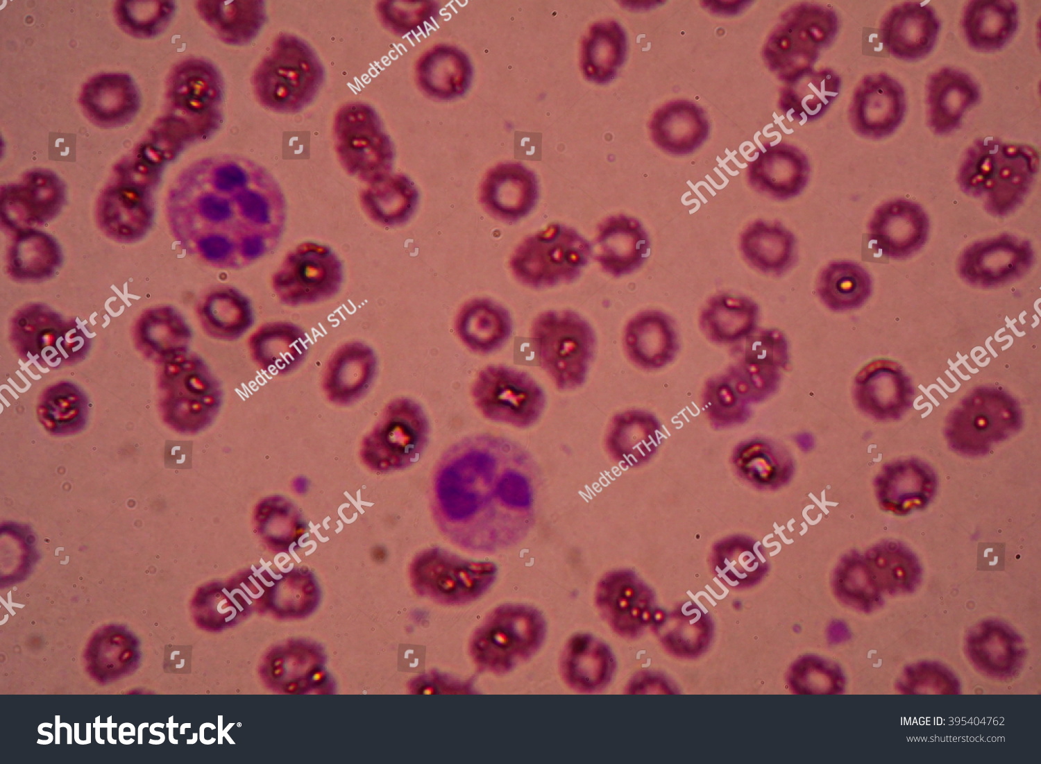 Blood Smear Showing Neutrophil Under Microscope Foto De Stock 395404762