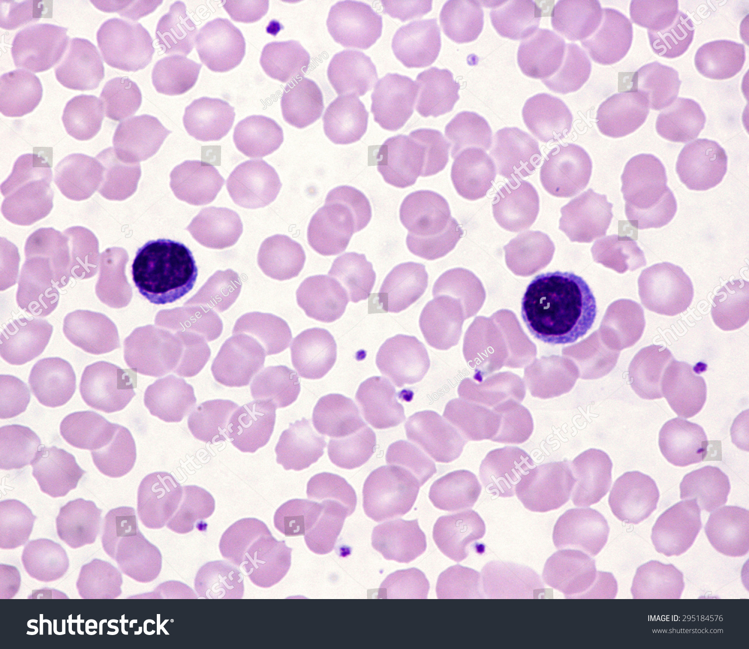 Blood Smear Showing Two Lymphocytes Small Stock Photo 295184576 ...