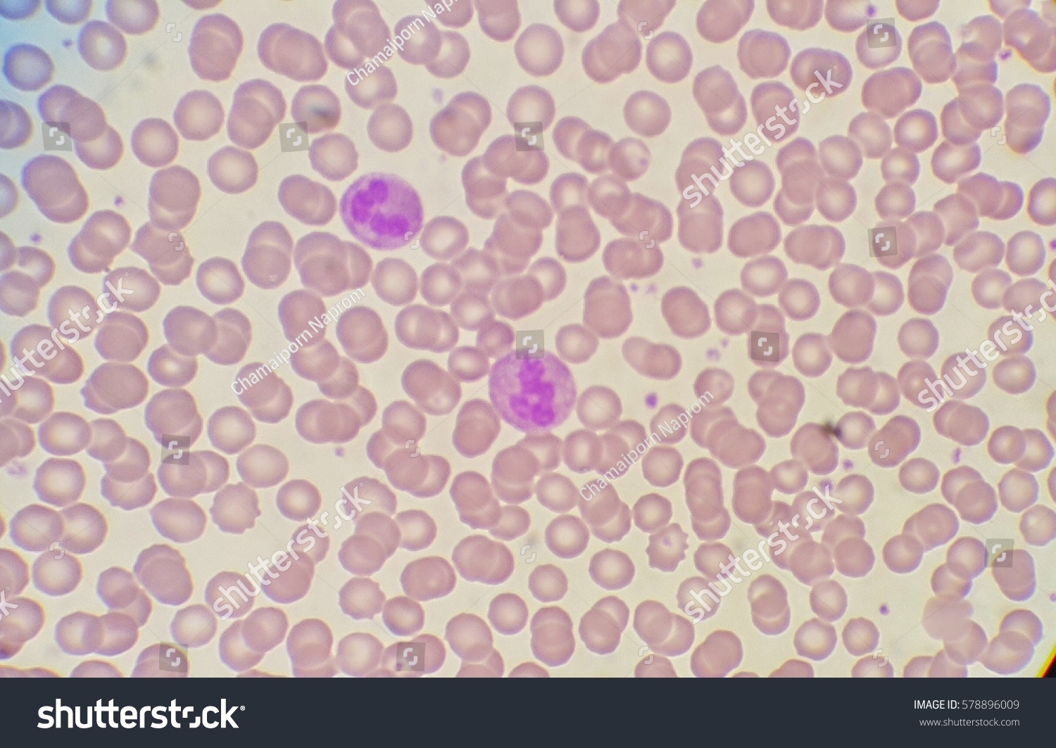 White blood cells under microscope