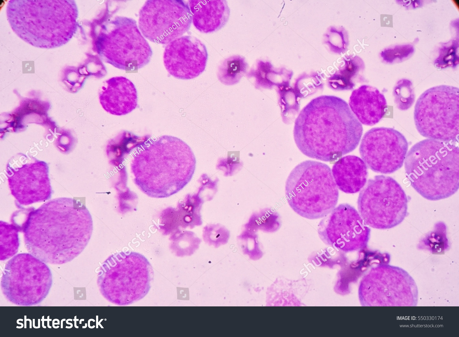 Blood Smear Under Microscopy Showing On Stock Photo 550330174 ...