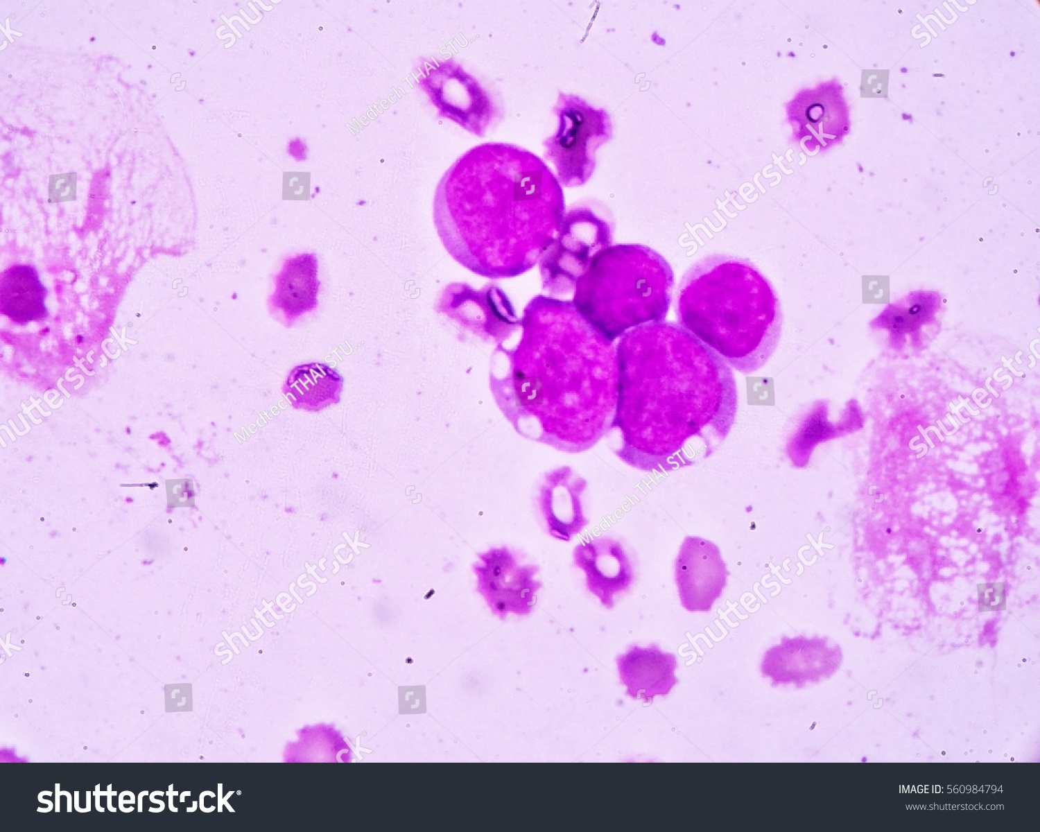 Blood Smear Under Microscopy Showing On Stock Photo (Edit Now) 560984794
