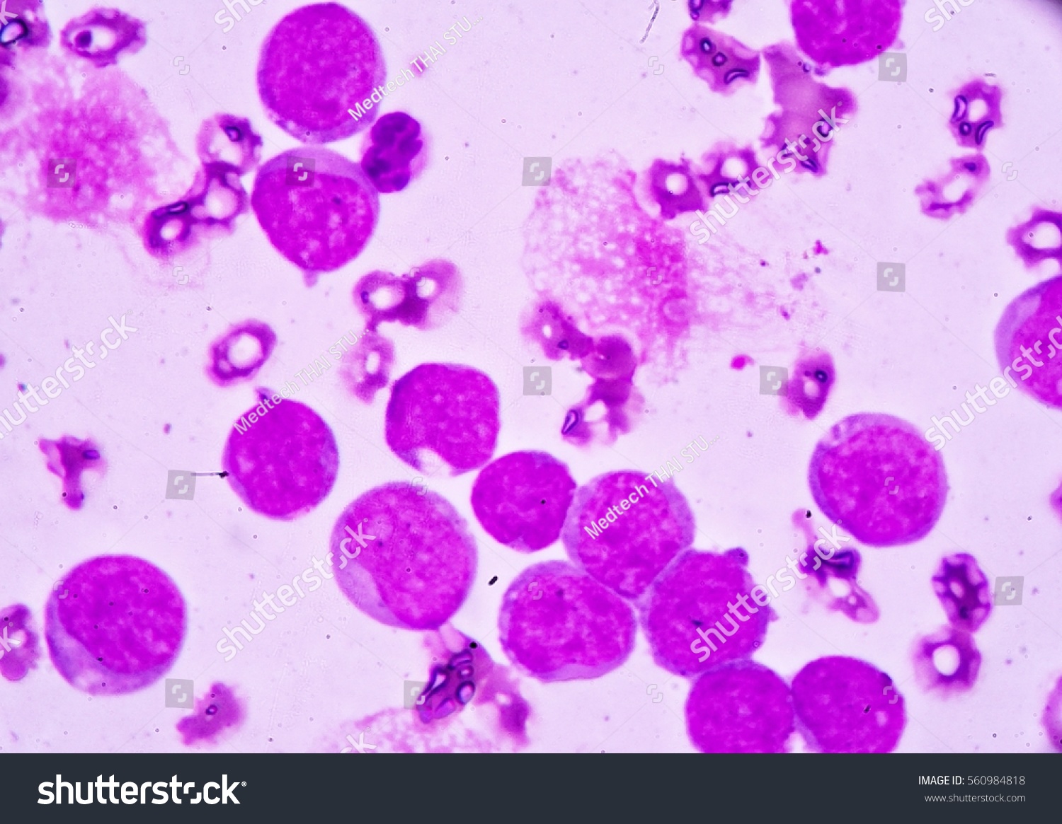 Blood Smear Under Microscopy Showing On Stock Photo (Edit Now) 560984818