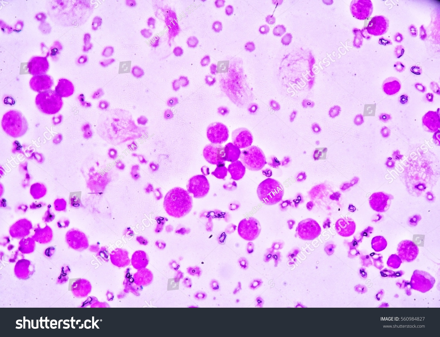 Blood Smear Under Microscopy Showing On Stock Photo 560984827 ...