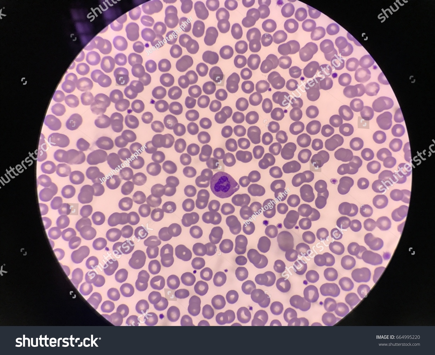 Blood Smear White Blood Cell Microscope Stock Photo (Edit Now) 664995220