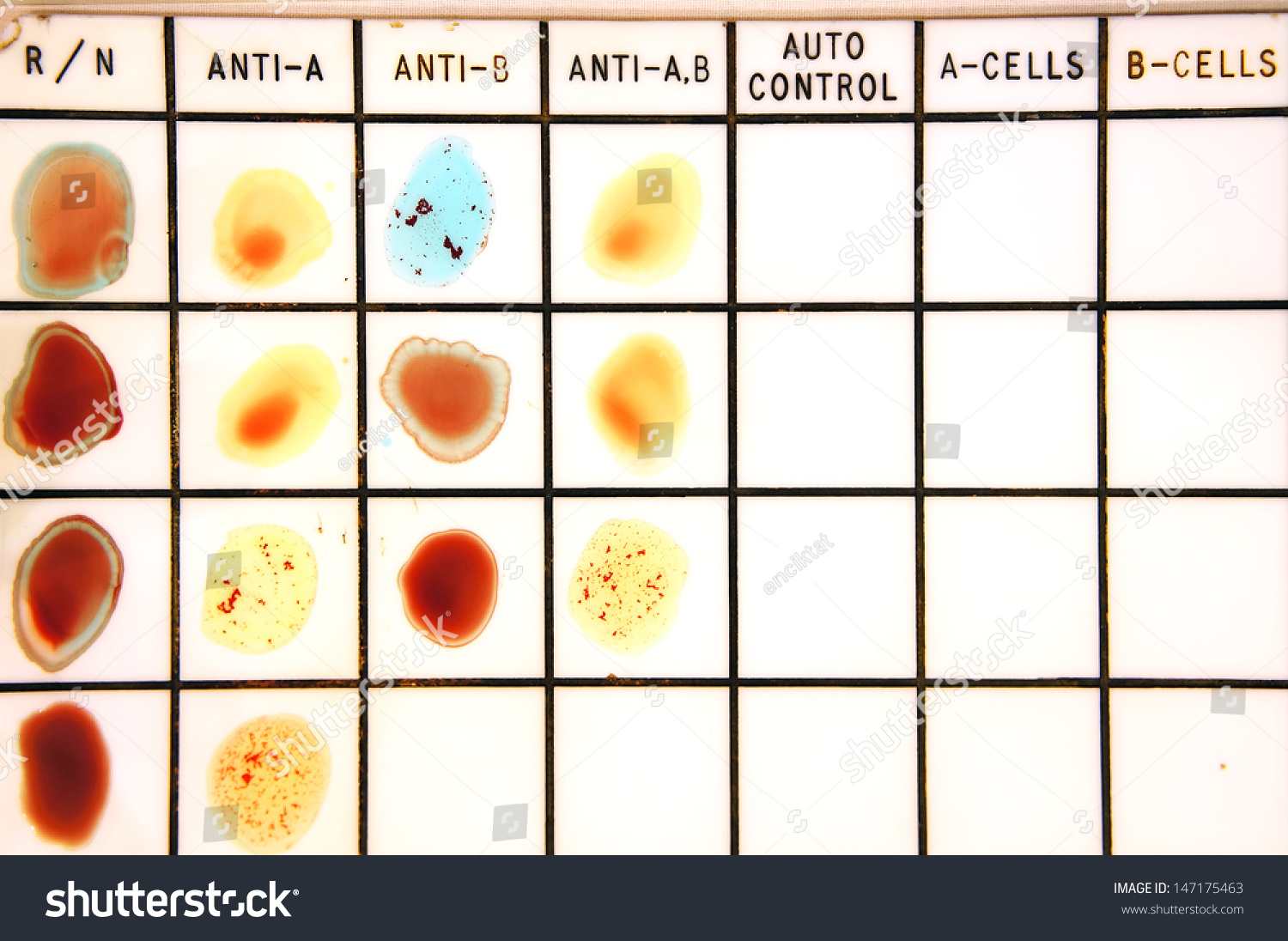 blood-type-test-stock-photo-147175463-shutterstock