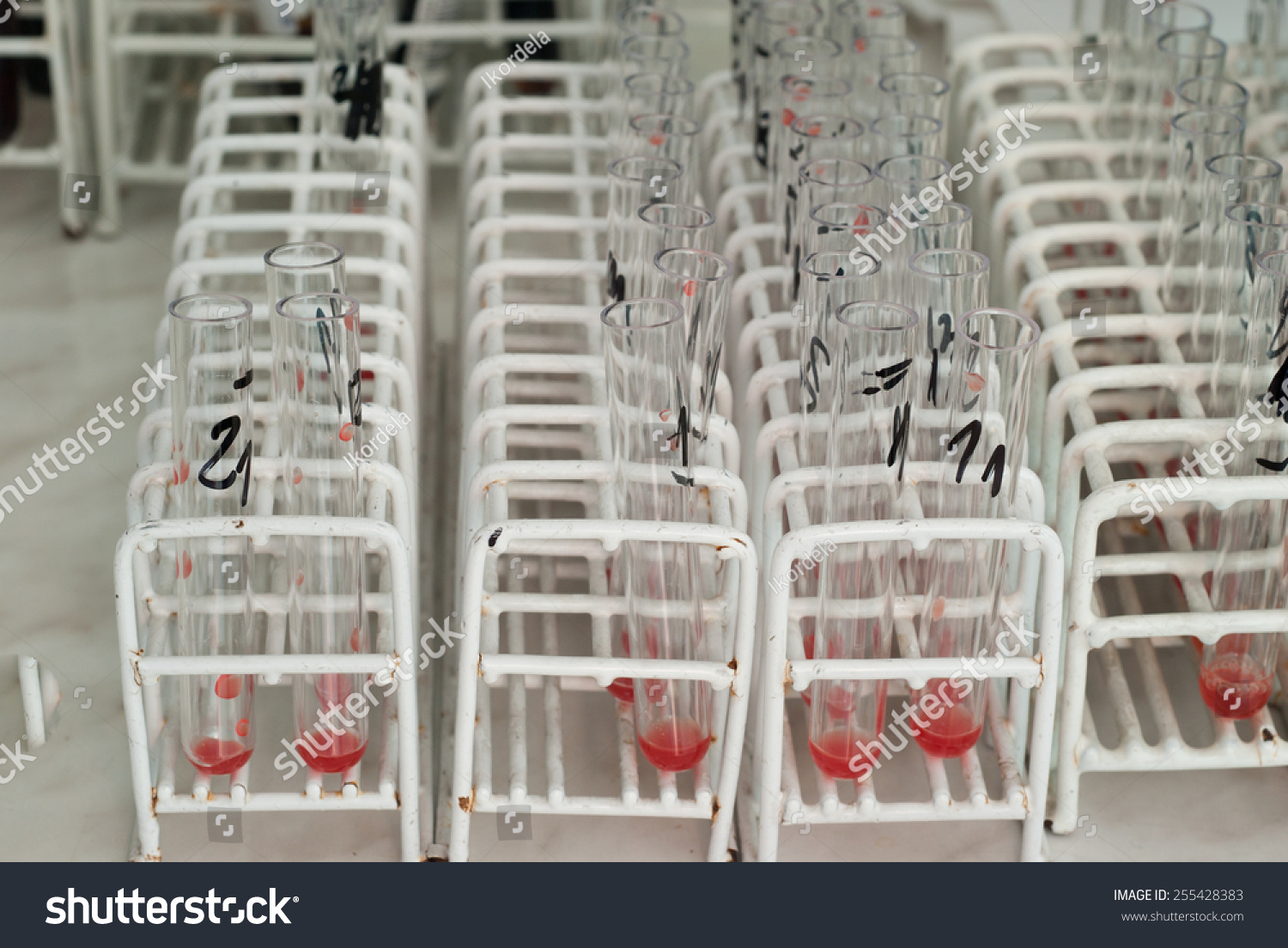 Blood Type Test Tubes Real Lab Stock Photo Edit Now 255428383