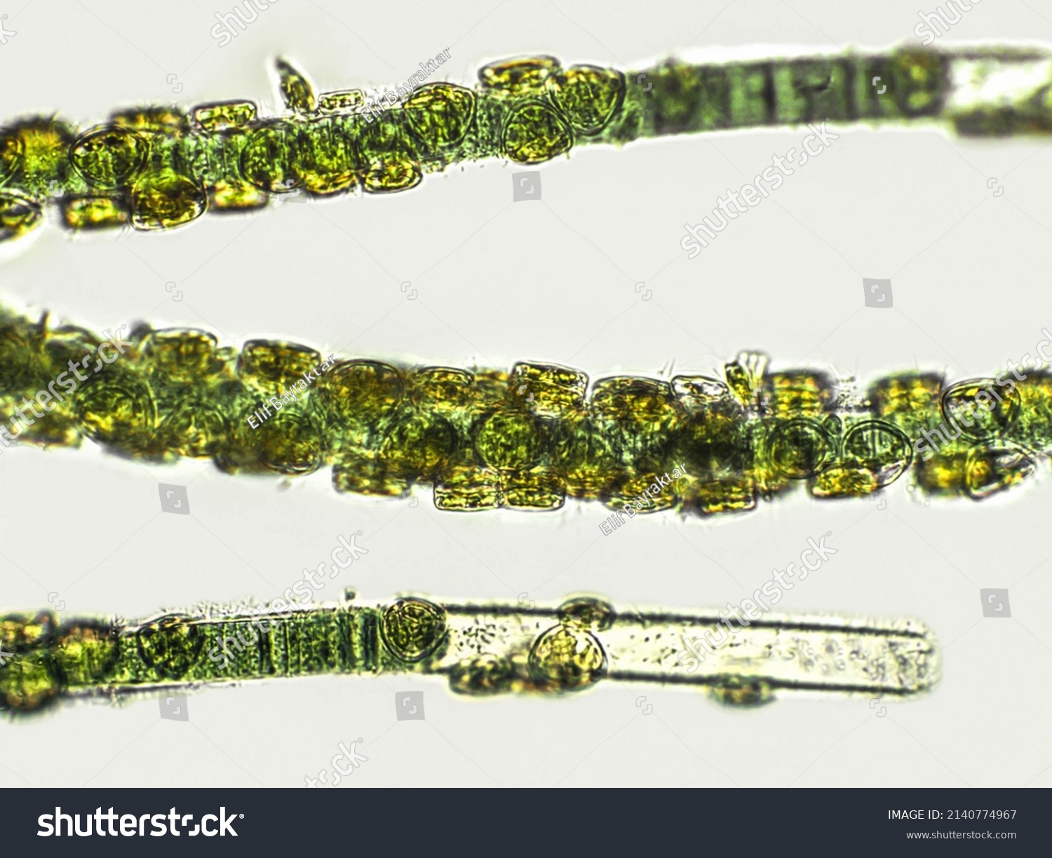 Blue Green Filamentous Algae Under Microscopic Stock Photo (Edit Now ...