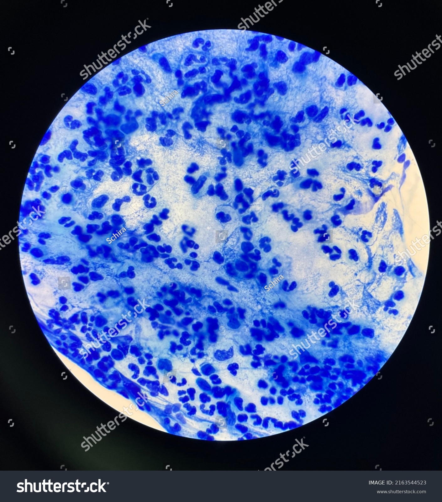 Blue White Blood Cell Sputum Smear Stock Photo 2163544523 | Shutterstock