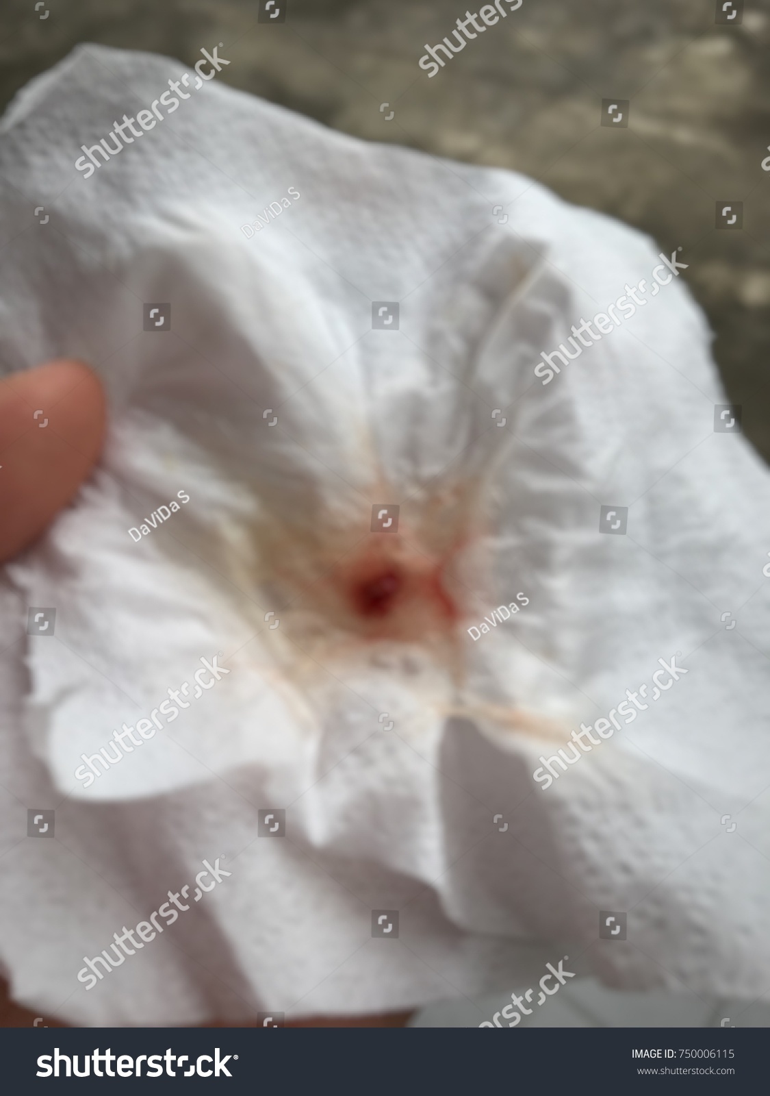 Blurred Photo Snotmucus Blood On Tissue Stock Photo Edit Now 750006115