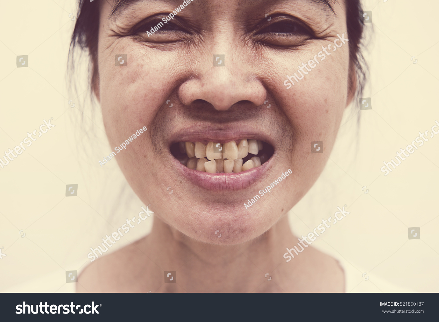Woman with rotten teeth