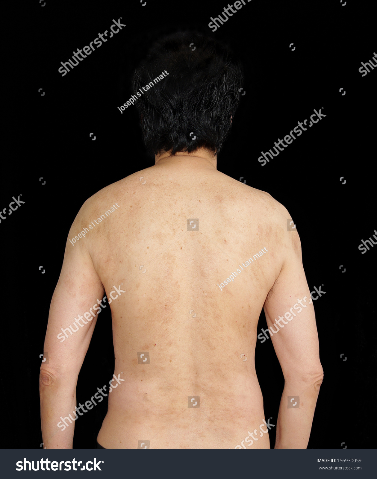 Body Parts Rear View Human Back Stock Photo 156930059 - Shutterstock