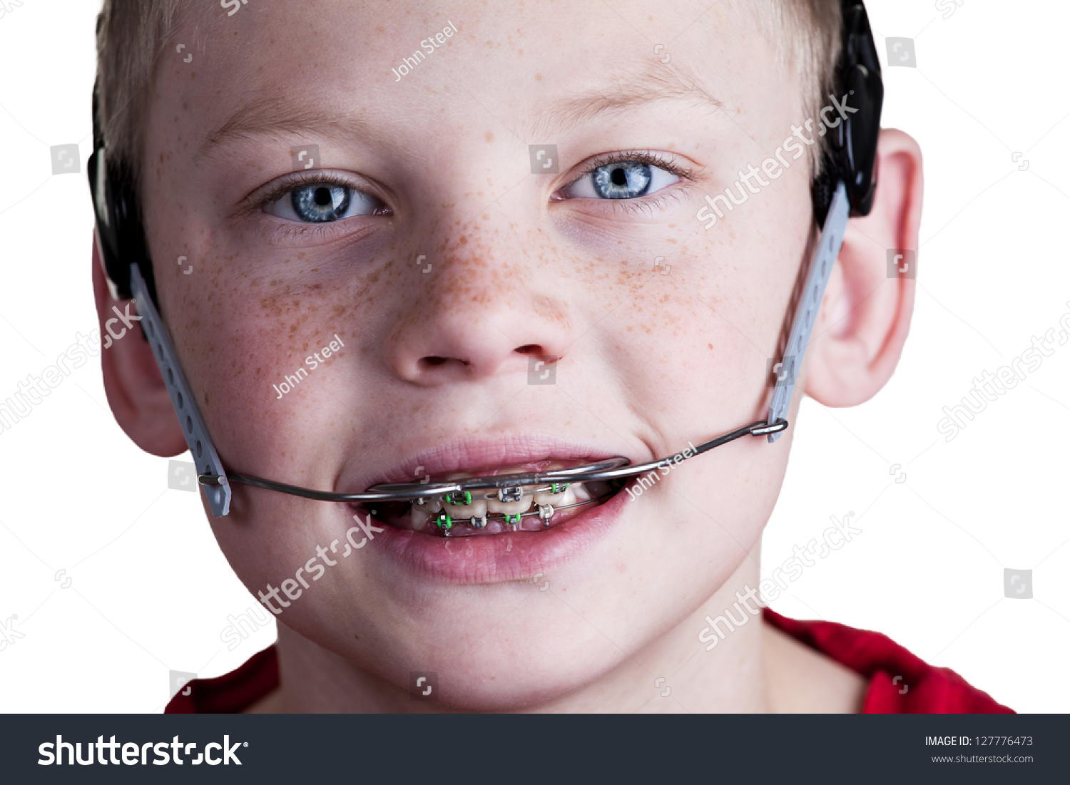 real stories of gay bottom from Asa gay boy with braces