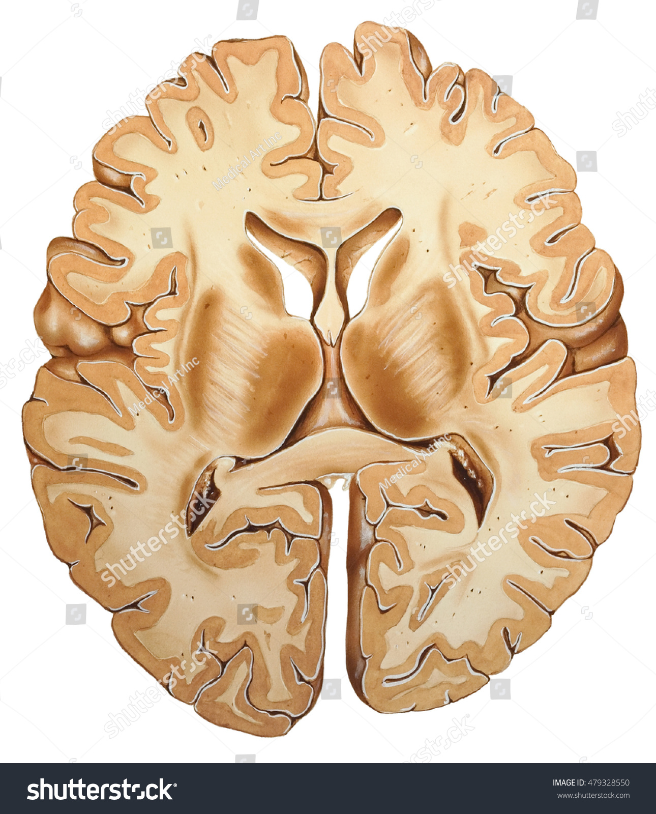 Cross Sectional Anatomy Of Brain