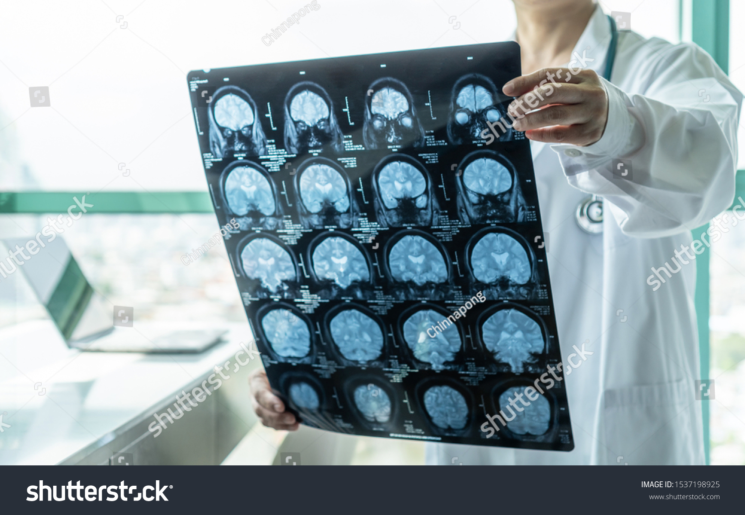 Neurological Disorders Images Stock Photos Vectors Shutterstock Neurological Disorders Images Stock Photos Vectors Shutterstock