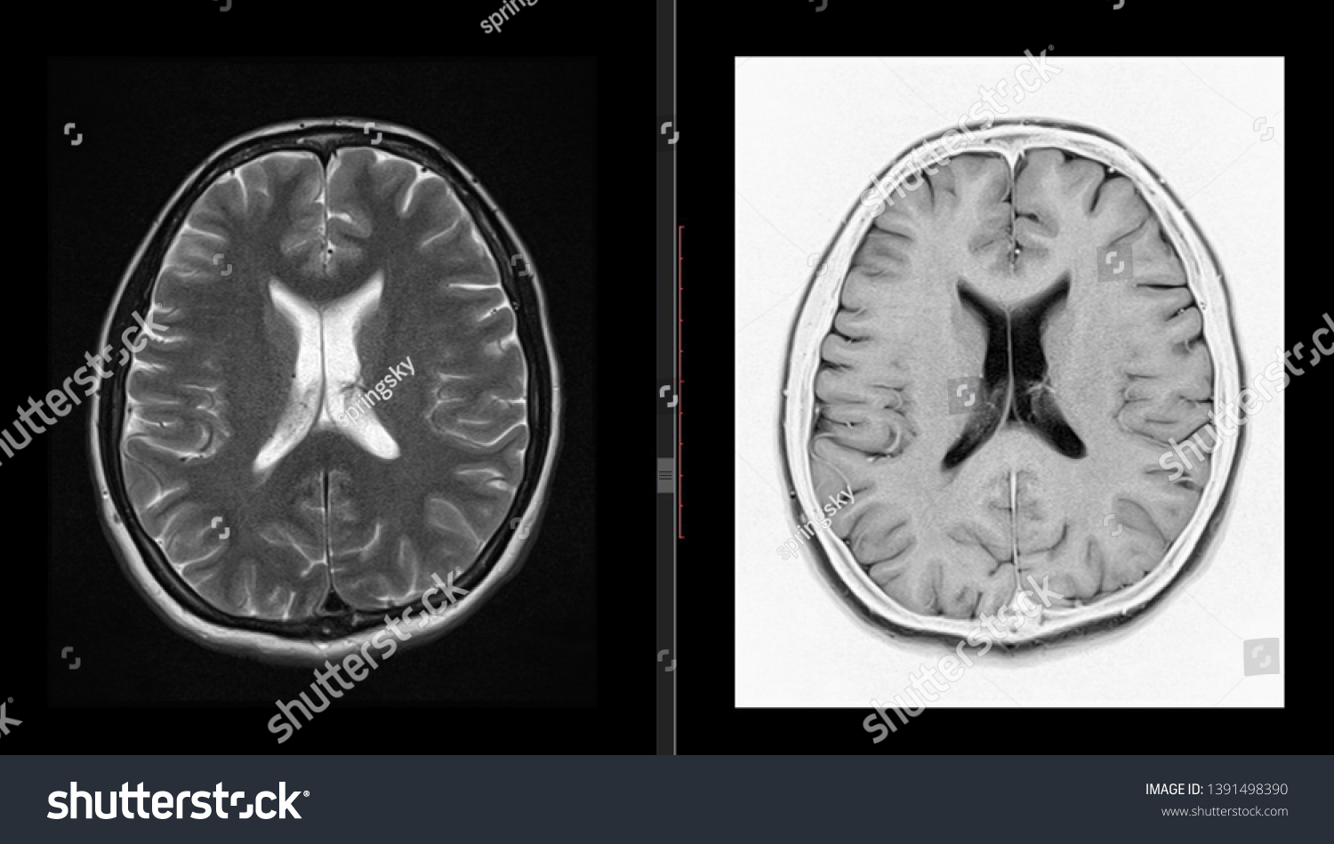 Brain Mri Scan High Resolution Head Stock Photo 1391498390 | Shutterstock