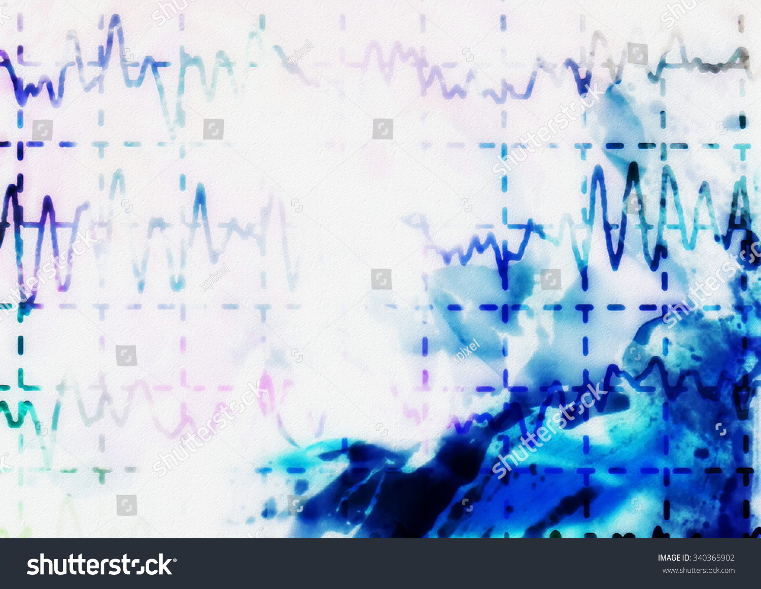 Brain Wave On Electroencephalogram Eeg Epilepsy Stock Illustration 340365902 Shutterstock 6437