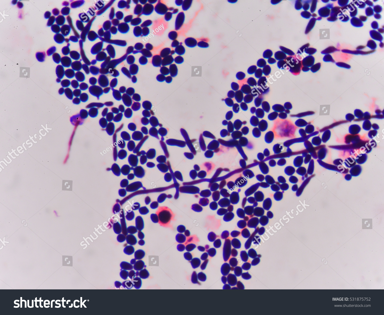 Branching Budding Yeast Cells Pseudohyphae Gram 库存照片 立即编辑