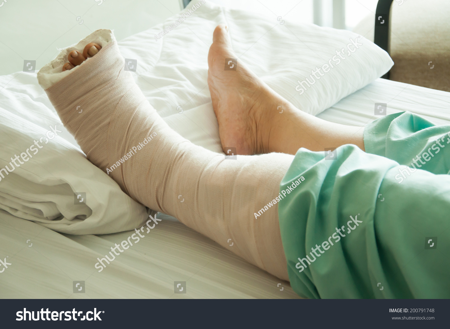 broken-leg-hospital-bed-stock-photos-images-photography-shutterstock