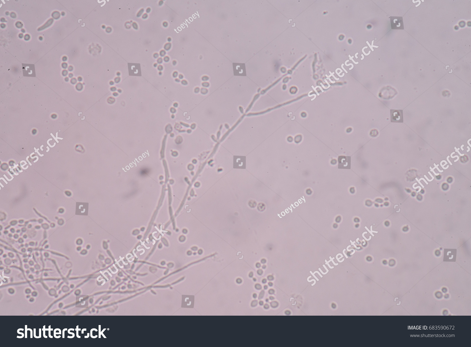 Budding Yeast Cell Structure Fine Microscope Stock Photo 683590672 ...