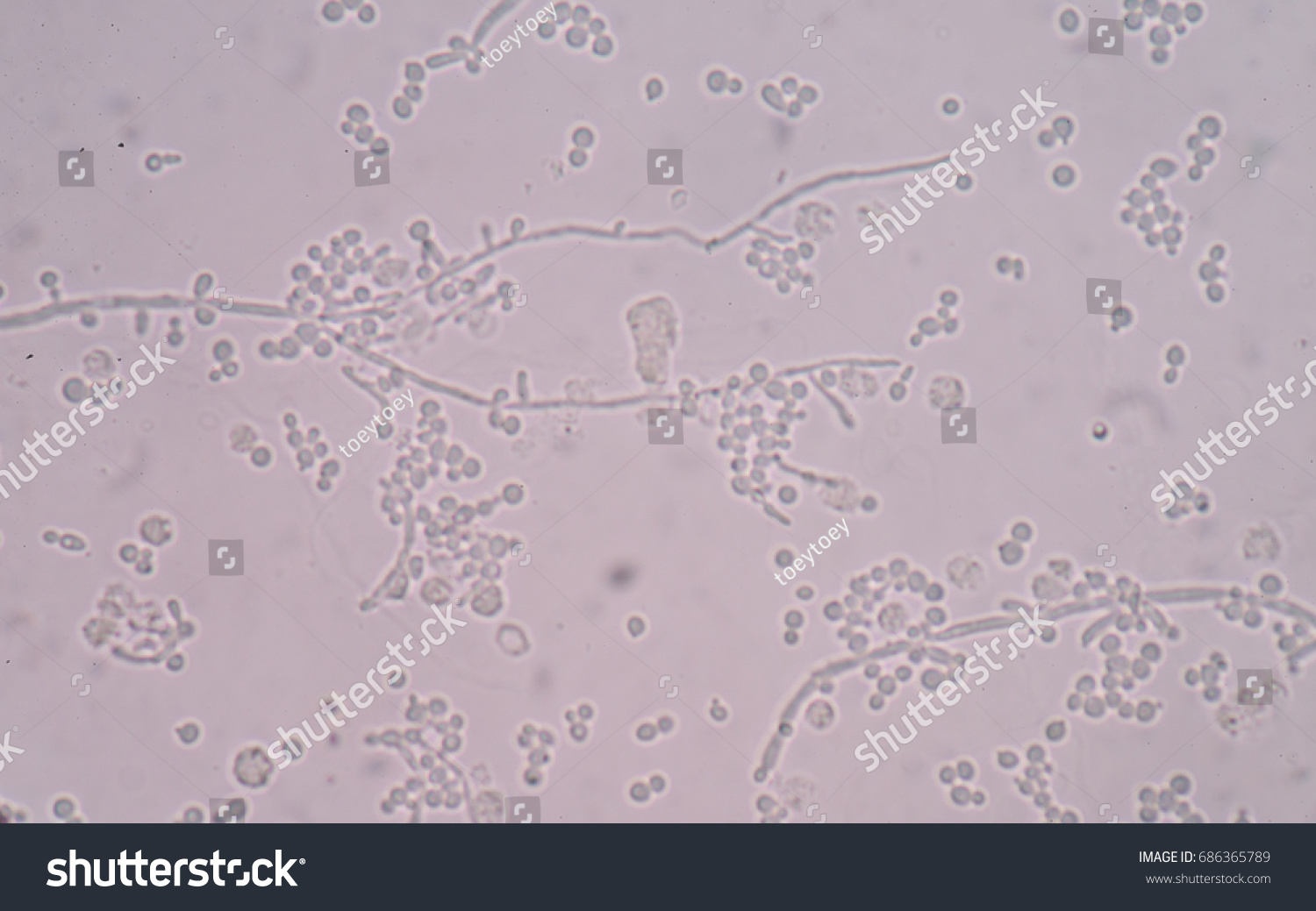 Budding Yeast Cells Stock Photo (Edit Now) 686365789