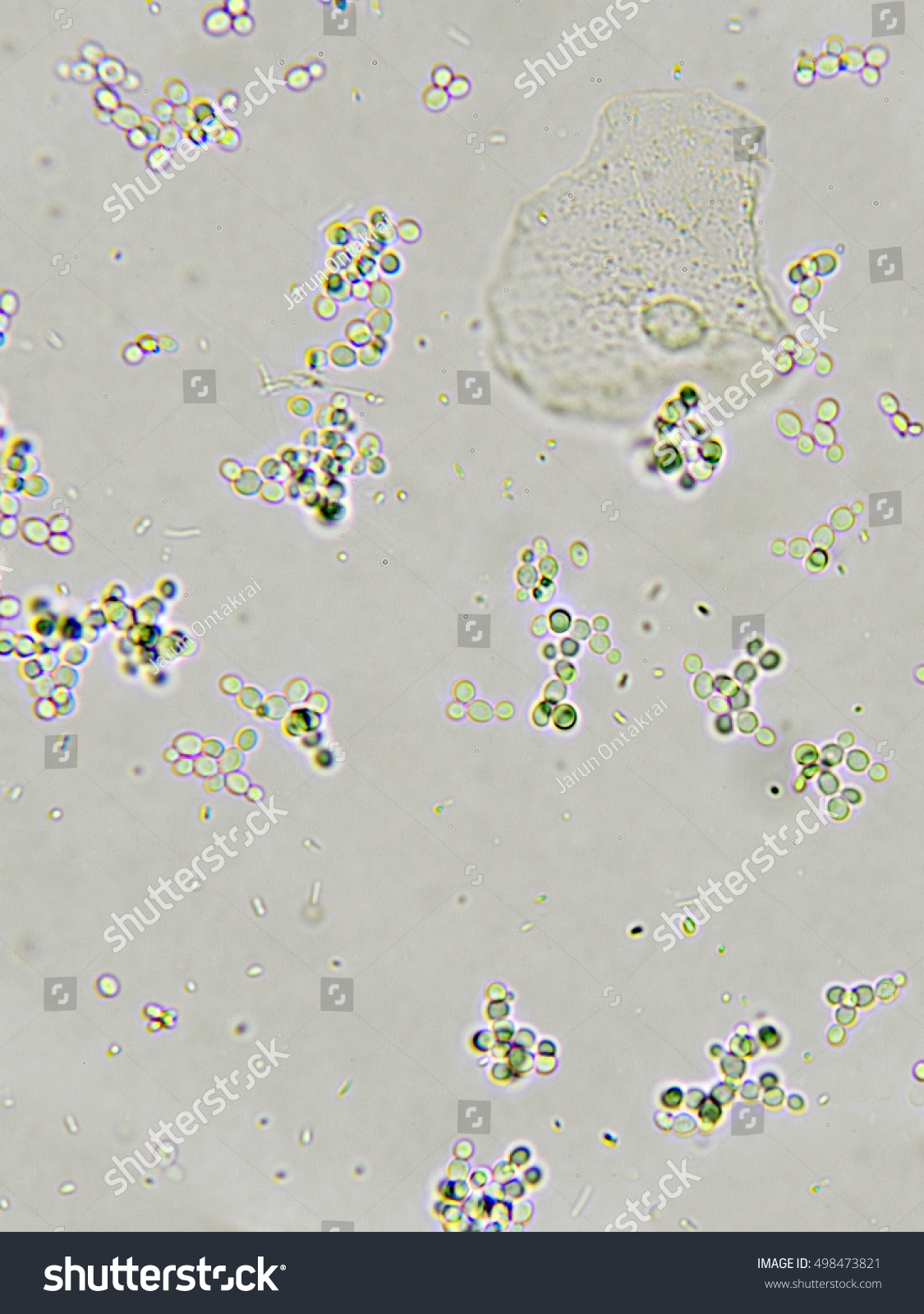 Budding Yeast Cells Bacteria Patient Urine库存照片498473821 Shutterstock