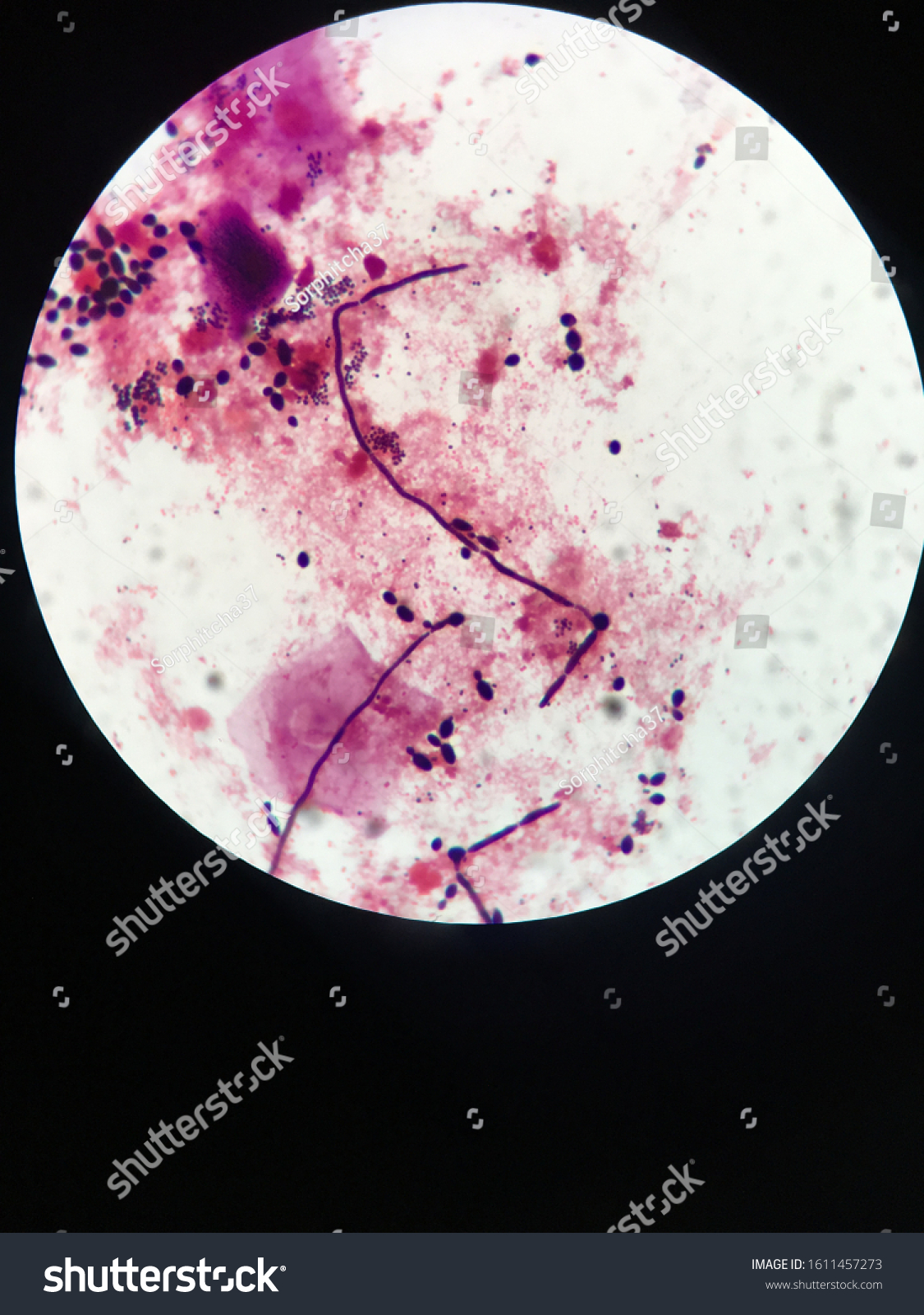 Budding Yeast Cells Pseudohyphae View Microscope Stock Photo 1611457273 ...