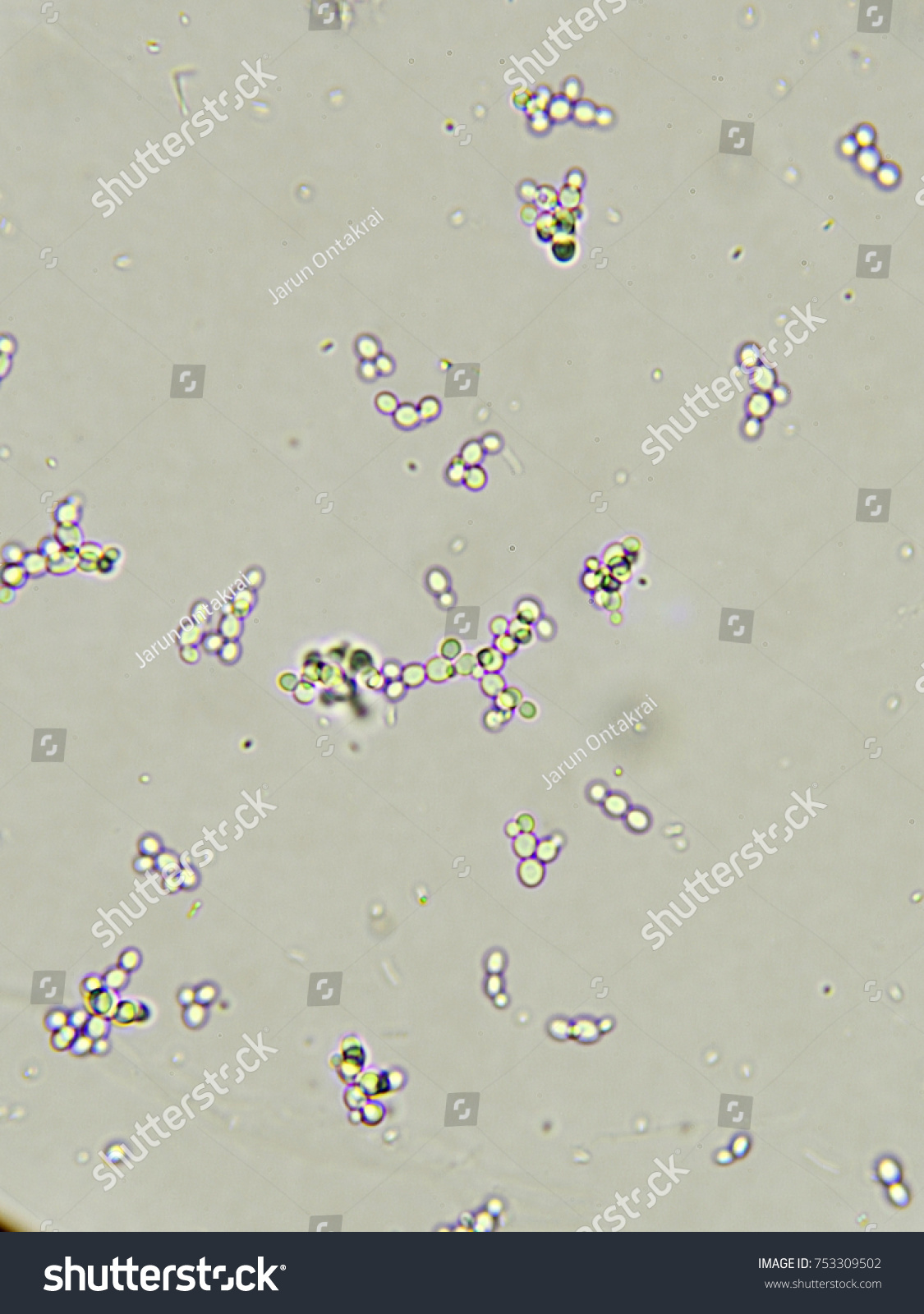 Budding Yeast Cells Patient Urine Urinary Stock Photo 753309502 ...