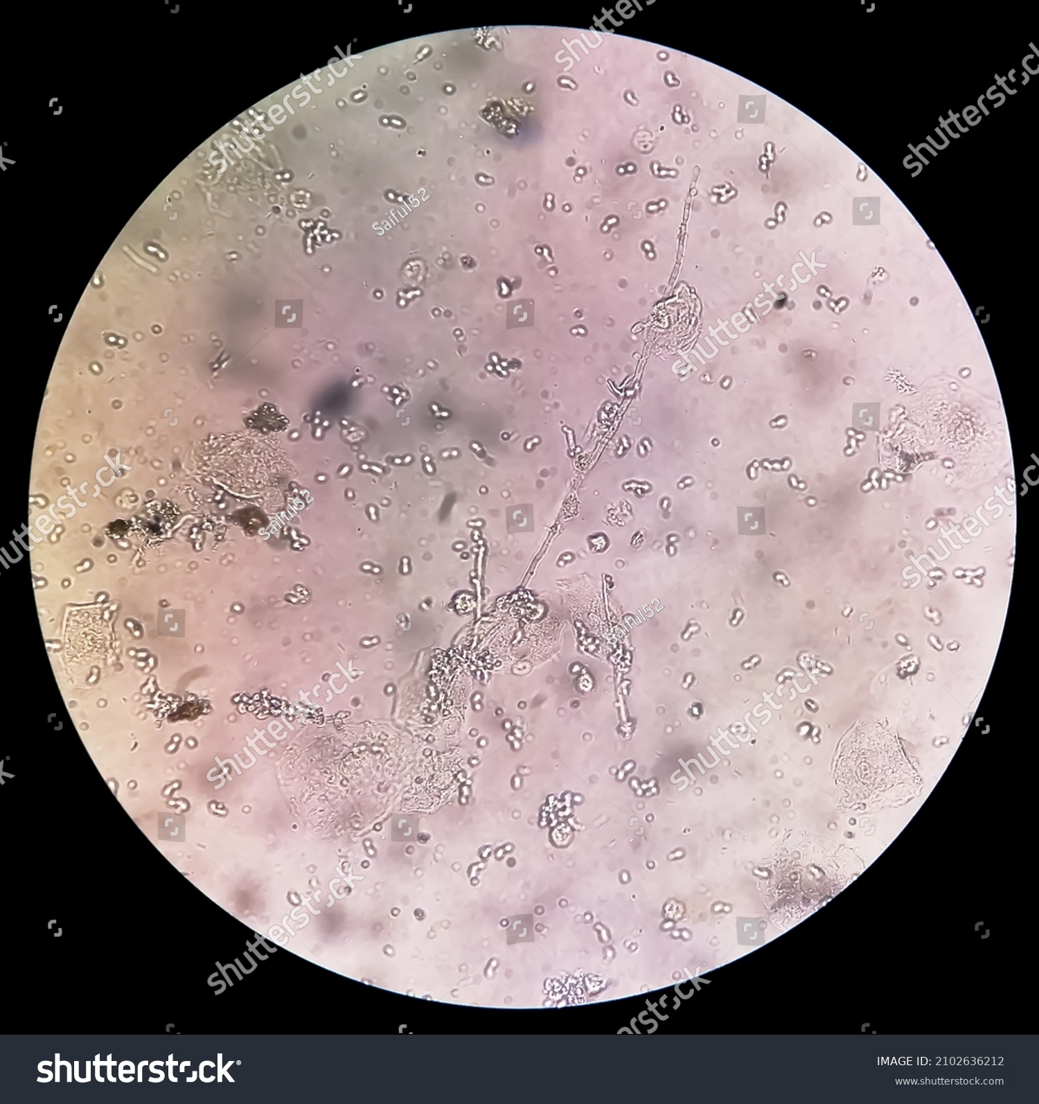 Budding Yeast Cells Urinalysis Urinary Tract Stock Photo Edit Now