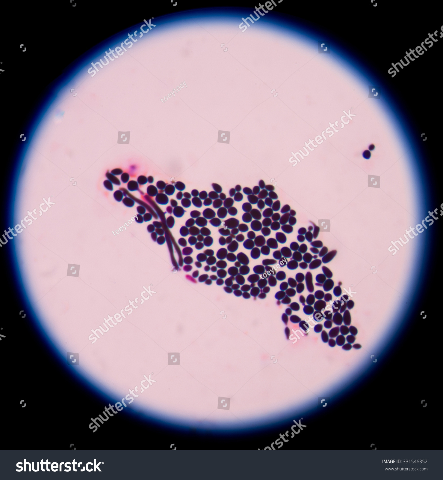 Budding Yeast Cells Pseudohyphae Stock Photo 331546352 | Shutterstock