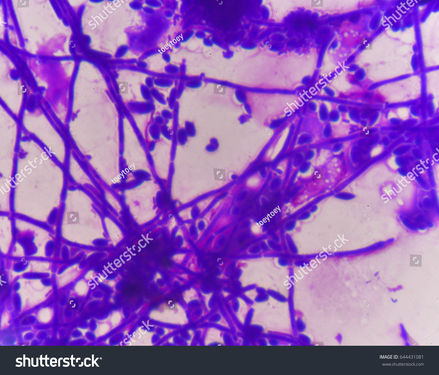 budding-in-fungi-coelenterata-porifera-protozoa-platyhelminthes-and