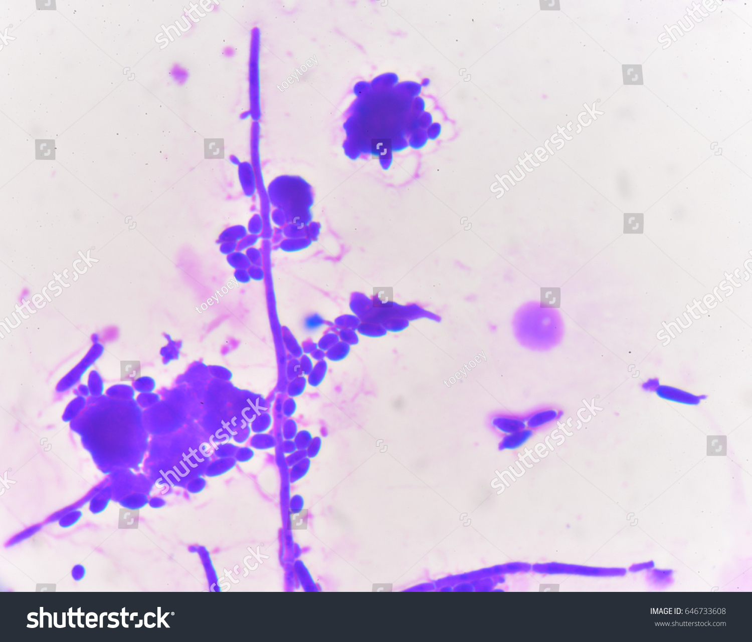 Budding Yeast Cells Pseudohyphae Gram Stain Stockfoto 646733608 Shutterstock