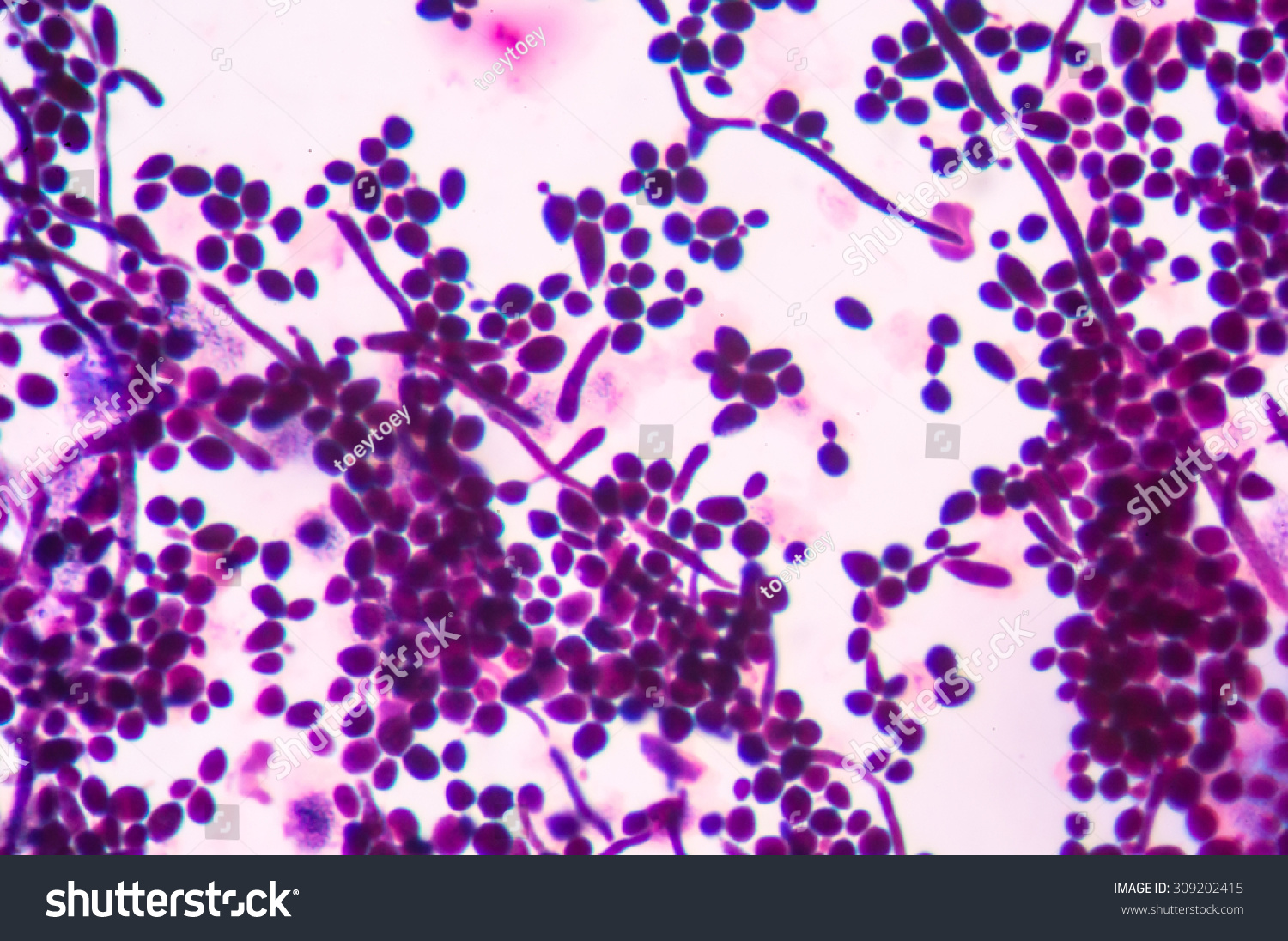 Budding Yeast Cells Pseudohyphae Urine Gram Stock Photo (Edit Now