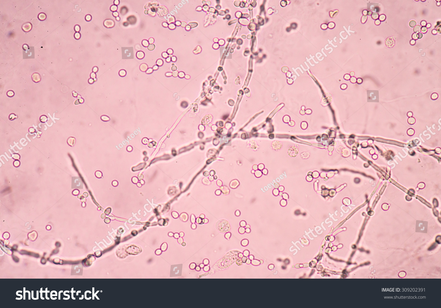 Budding Yeast Cells Pseudohyphae Urine Sample Stock Photo (Edit Now ...
