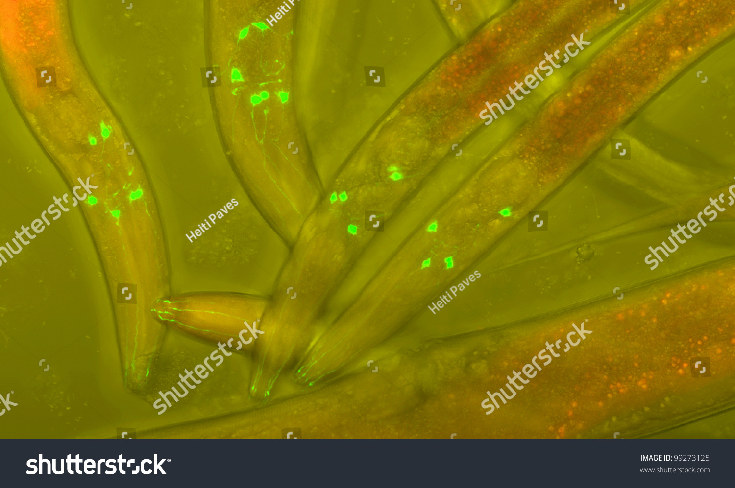 Caenorhabditis Elegans Freeliving Transparent Nematode Roundworm Stock ...