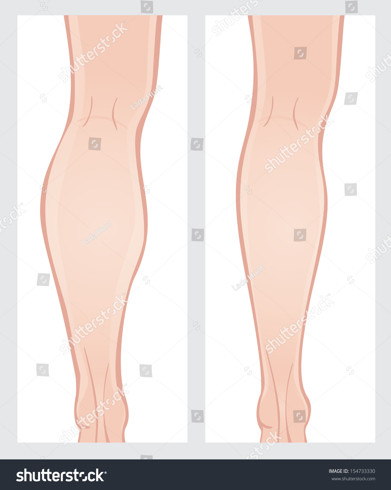 I want to lose weight in 5 weeks picture 8