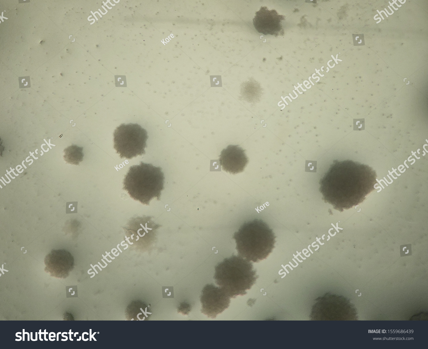 Candida Albicans Colonies Under Microscope Stock Photo (Edit Now ...