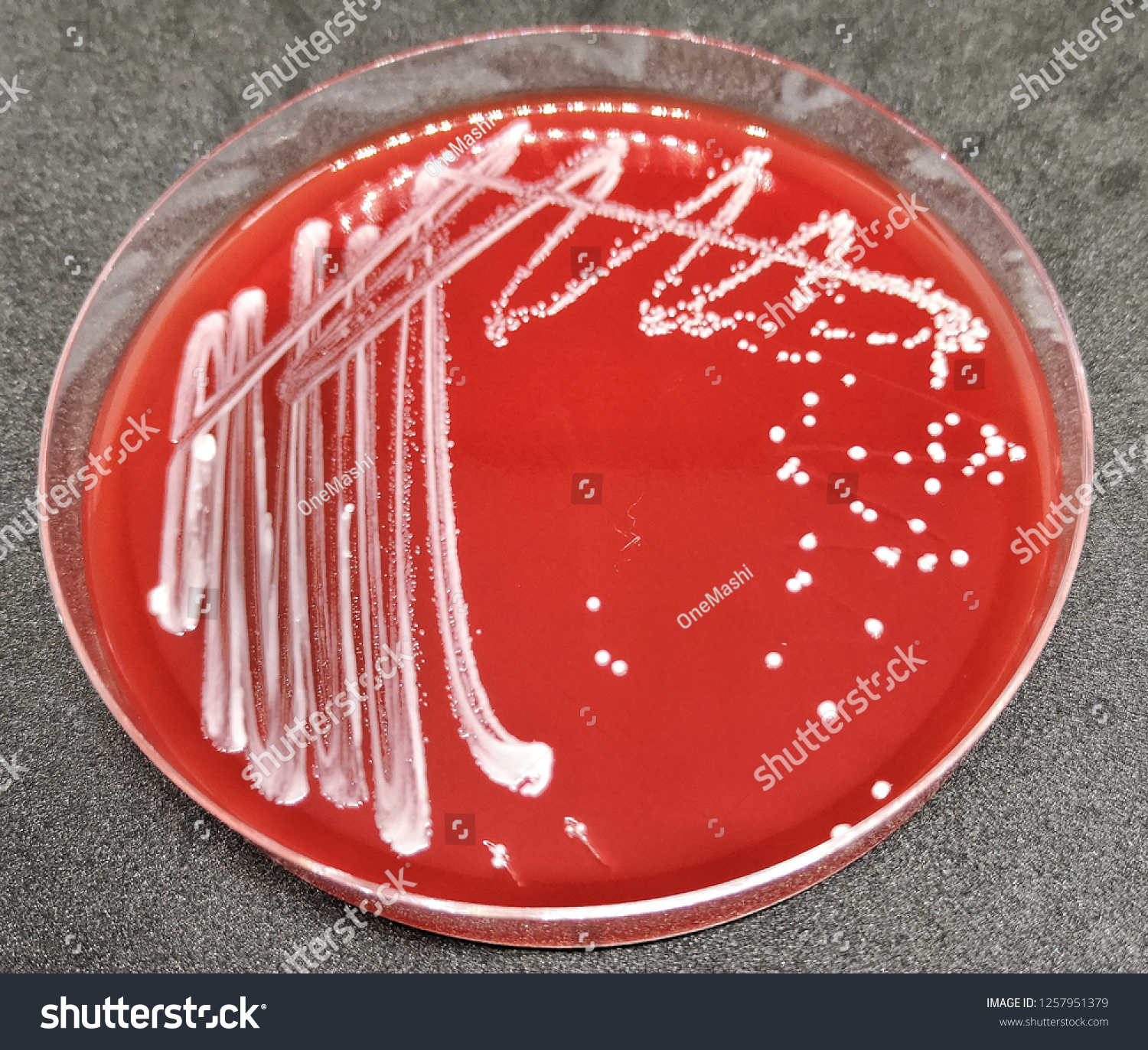 Candida Albicans On Blood Agar の写真素材 今すぐ編集 1257951379