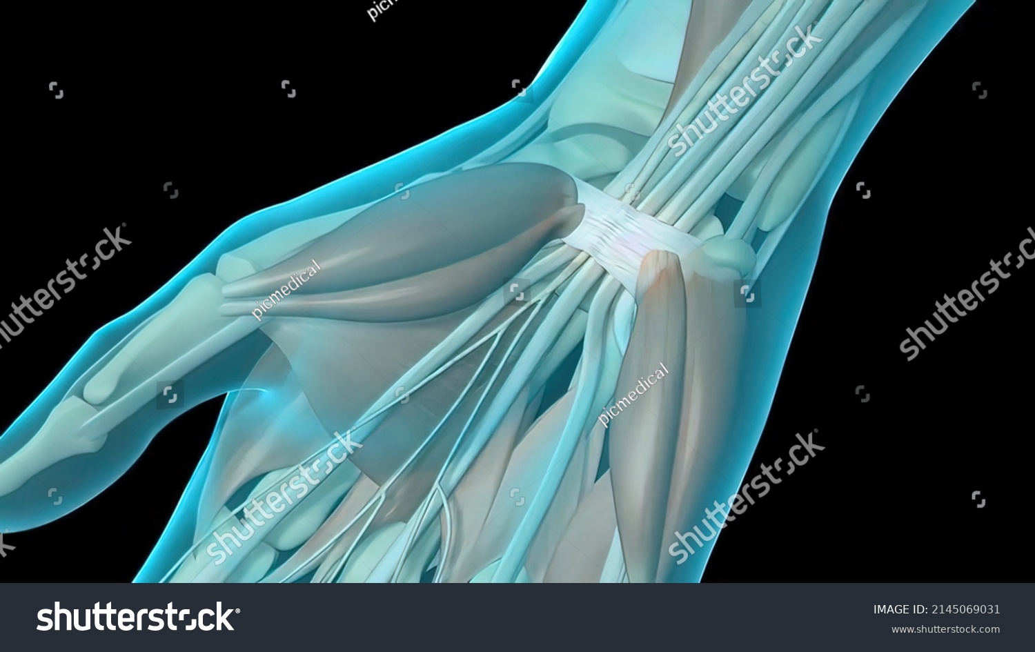 Carpal Tunnel Syndrome Cts Numbness Tingling Stock Illustration 2145069031 Shutterstock