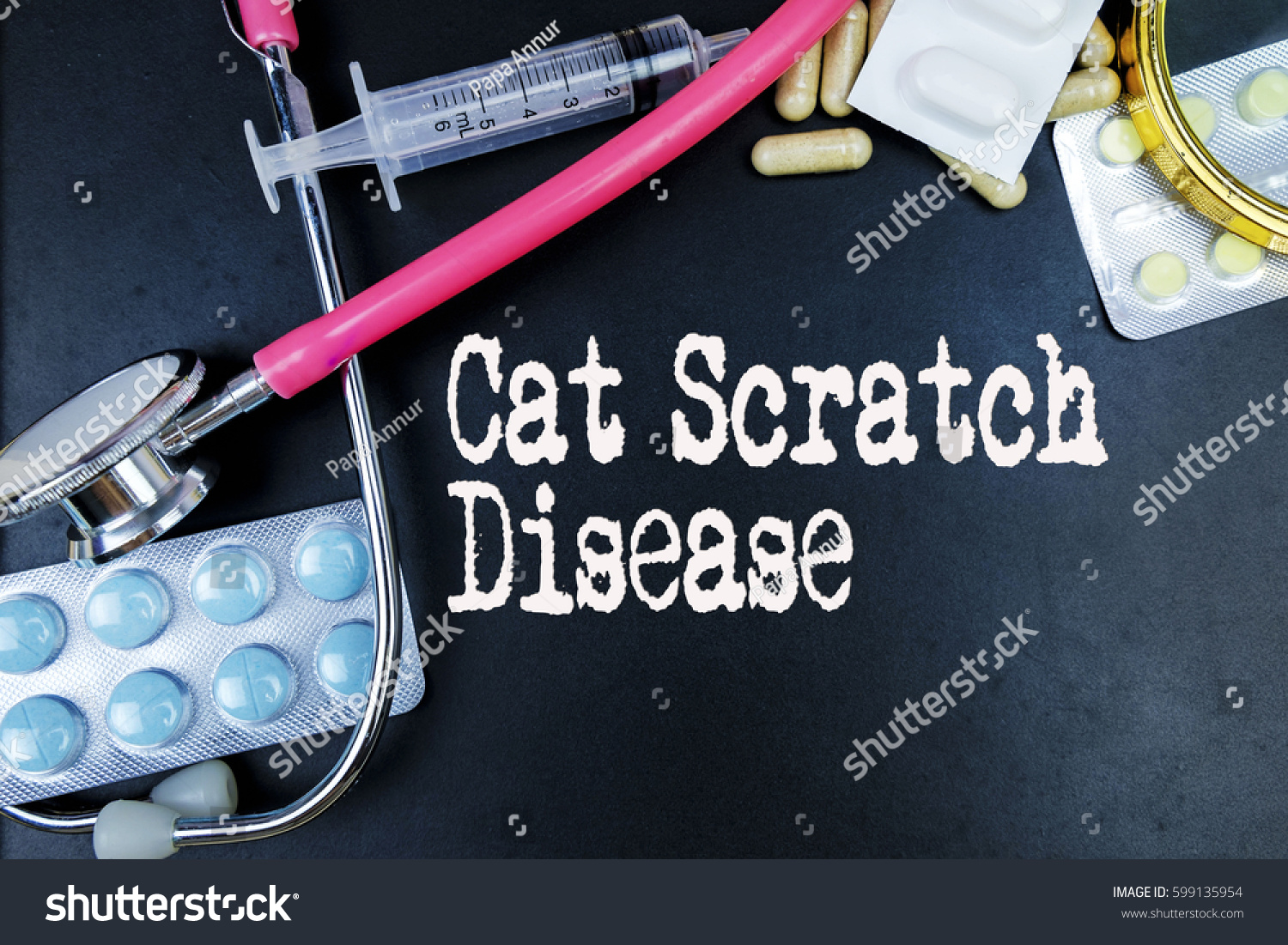 Cat Scratch Disease Word Medical Term Stock Photo (Edit Now) 599135954