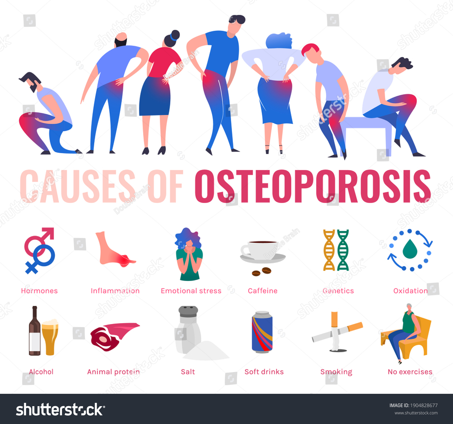 Causes Osteoporosis Bone Loss Medical Infographic Stock Illustration ...