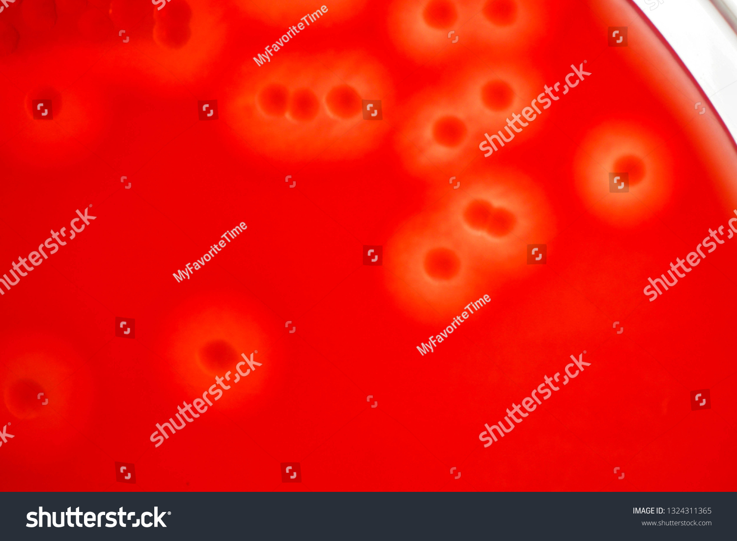 Charateristic Complete Hemolysis Bacterial Colonies On Foto De Stock