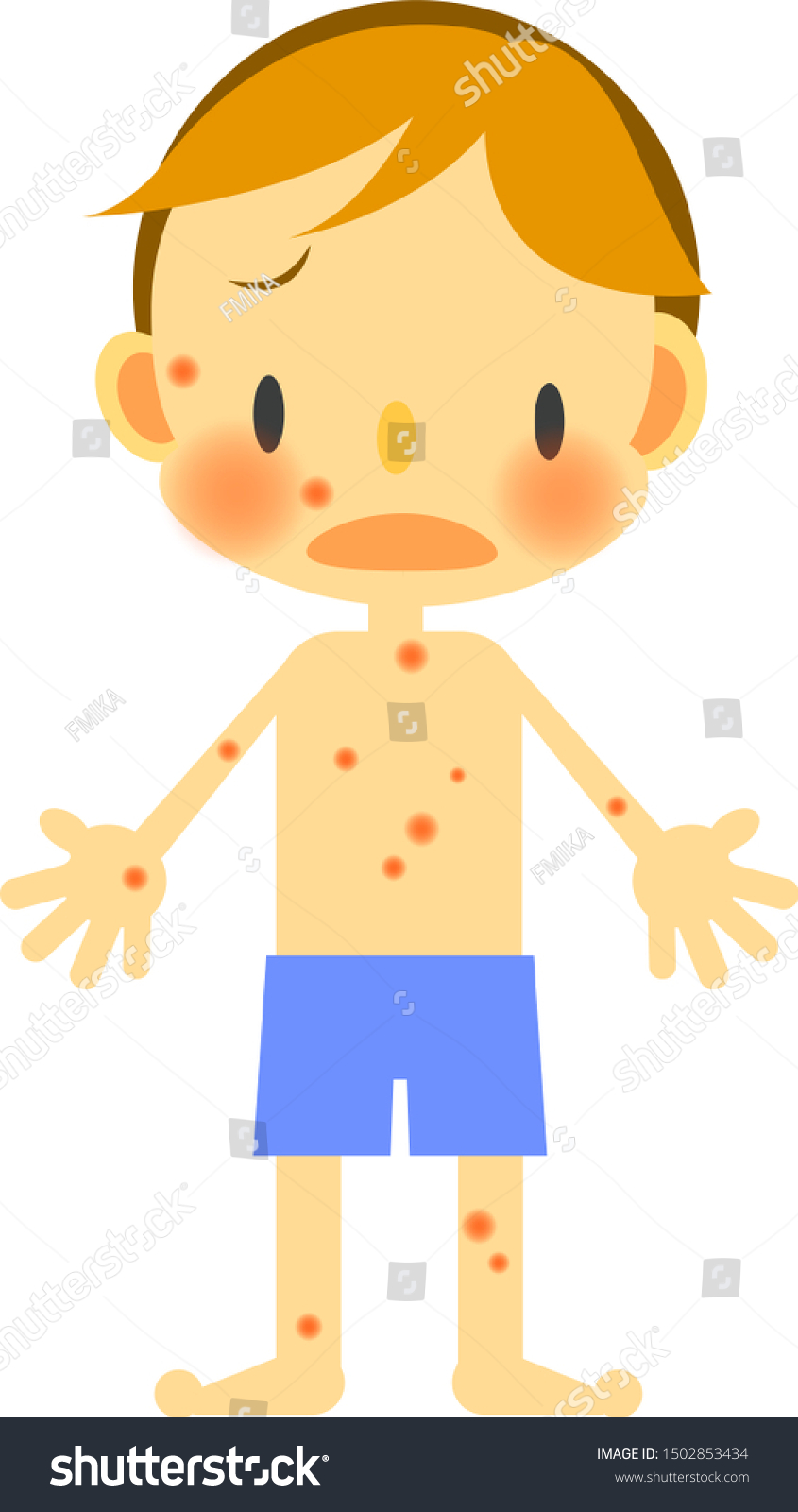 Child Sick Condition Rash Stock Illustration 1502853434 | Shutterstock