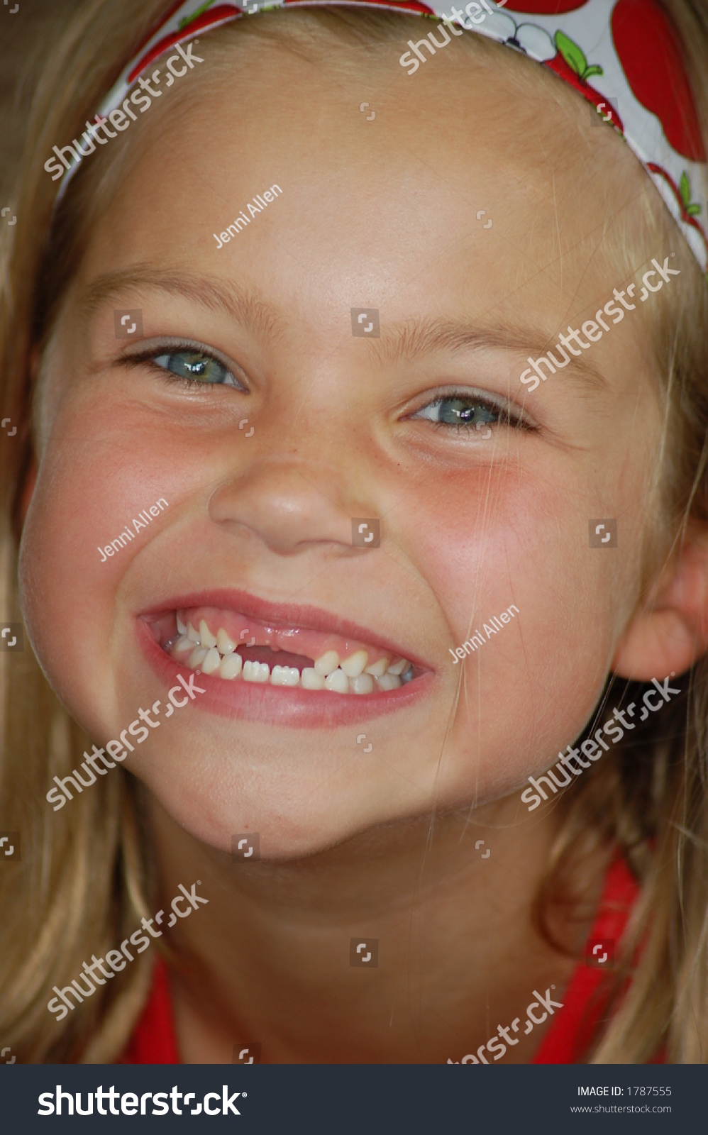 Two front teeth missing
